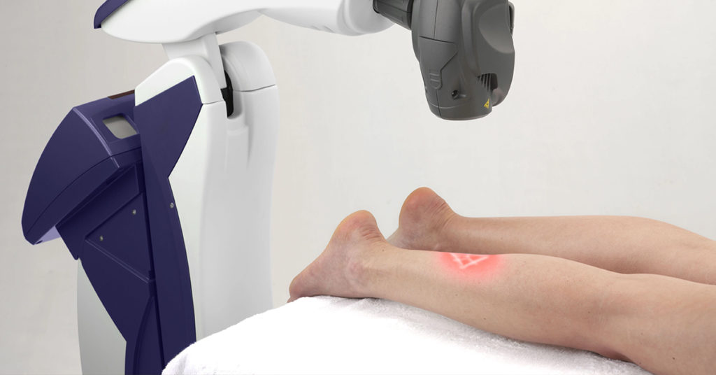 Mls Laser Therapy Carolina Arthritis